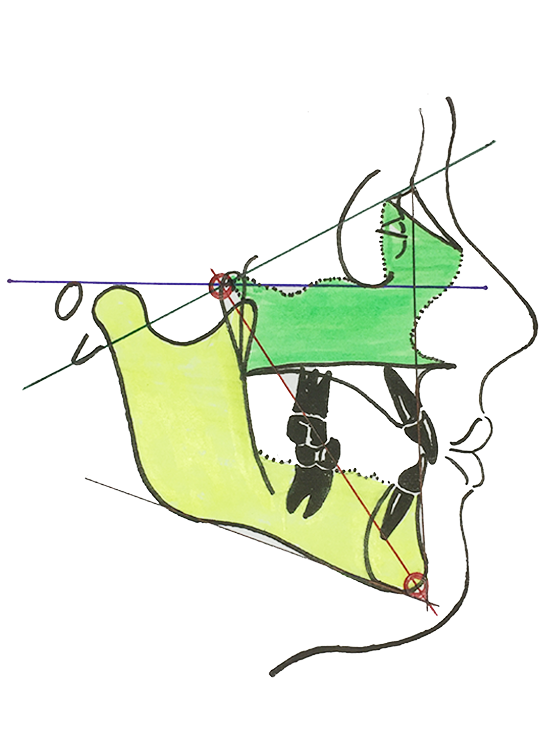 Schädelbasisachse 