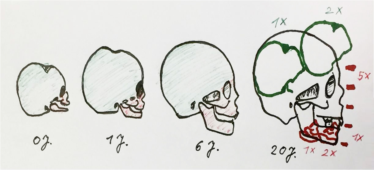 CranioPlan® Schädelwachstum