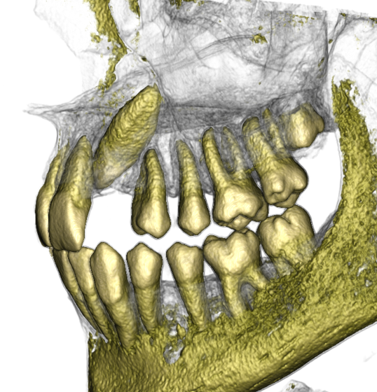 DVT 3D-Ansicht 