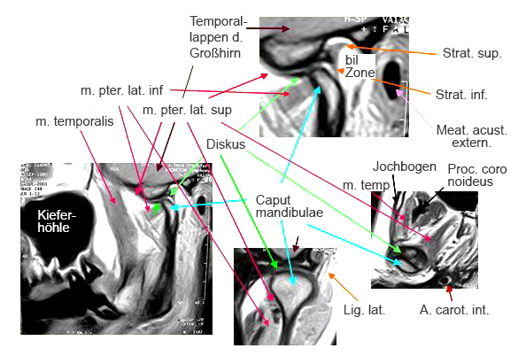 Kiefergelenk Anatomische Strukturen