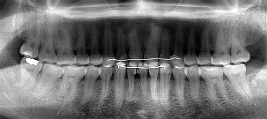 orthopantomogramm 