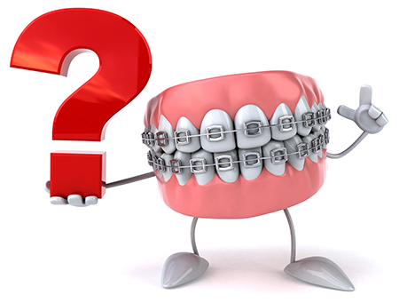 Wie lange dauert ein Zahnabdruck für eine Zahnspange?