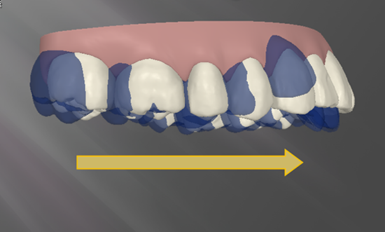 alveoläre Mesoalbewegung