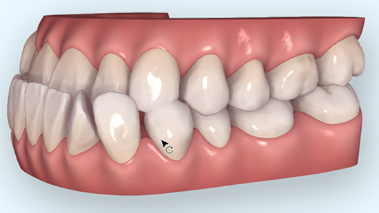 ASR links