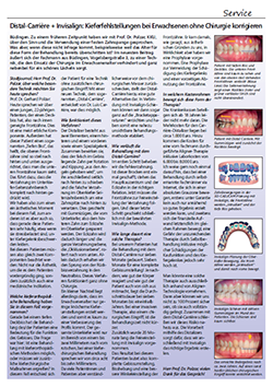 Distal-Carrière & Invisalign®